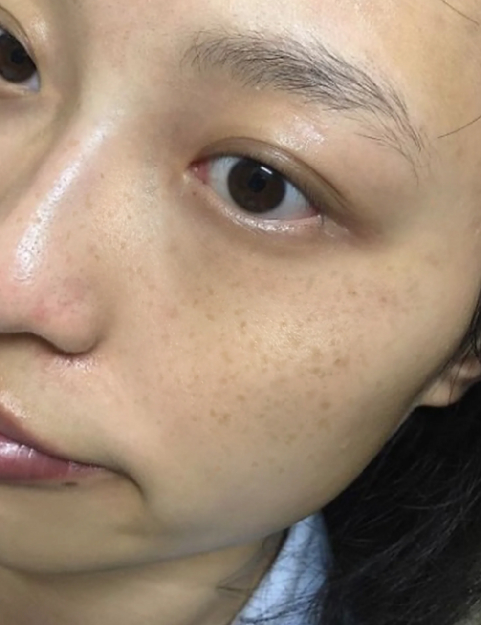 尤其是色斑问题,很多人都会困扰于此.那么,如何有效祛斑嫩肤呢?