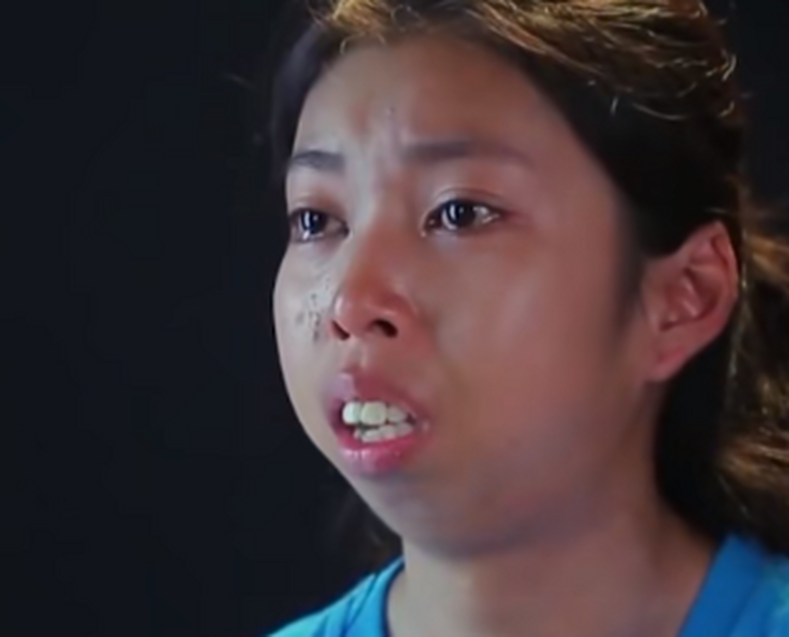 一个泰国女孩,因为自己没有下巴被面试公司拒绝而自卑,经过整容后获得