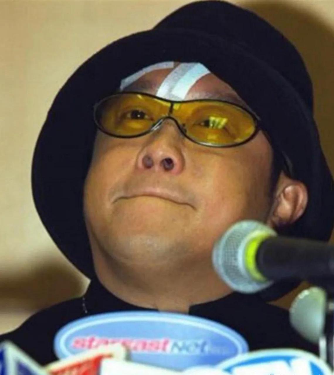2001年7月7日,曾志伟在香港某酒吧突然被袭击打成猪头,据悉,其面部