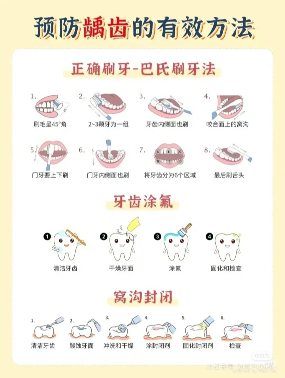 儿童防龋的有效方法: 1,巴氏刷牙法 2,牙齿涂氟 3,窝沟封闭 很多家长