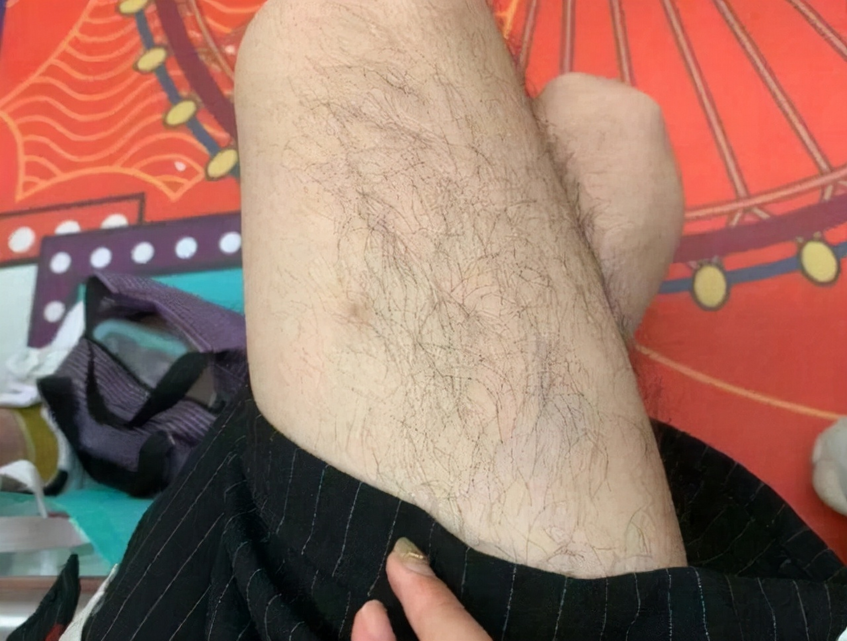 女性这些地方毛发异常旺盛,说明你的雄激素高了!    1.