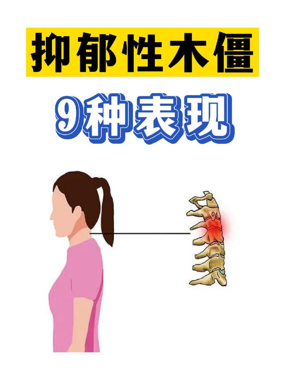 指动作行为和言语活动被完全抑制.