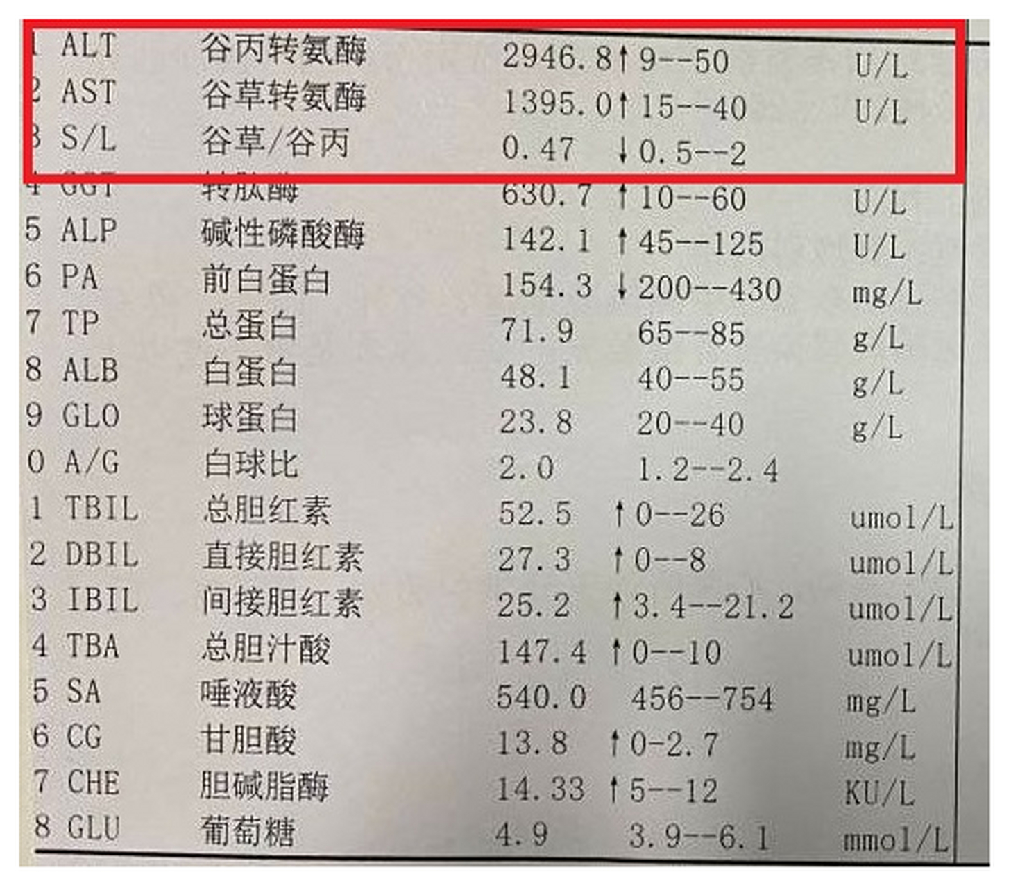 希望大家這兩項指標永遠也不會高 1,谷丙轉氨酶(alt) 參考值0-41