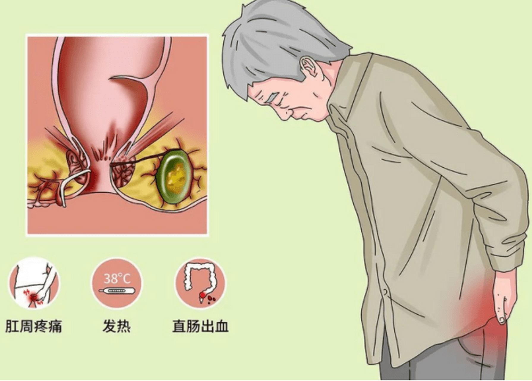 北京肛肠医院做个直肠镜多少钱,选#北京丰益肛肠医院# 北京丰益肛肠