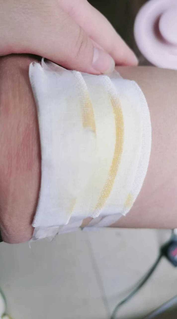 周一提前拜年摔个狗吃屎,裤子没破两条腿