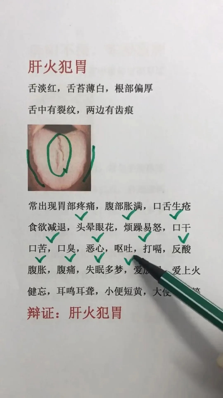 1,舌淡红,舌苔薄白,根部偏厚,舌中有裂纹,两边有齿痕.