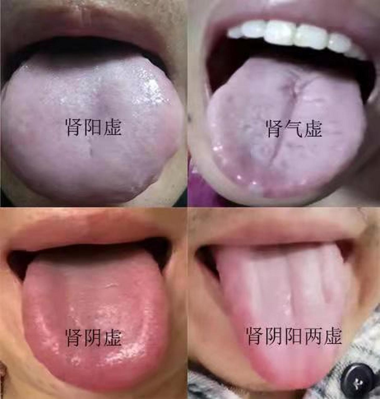 女人肾虚的六大表现图片