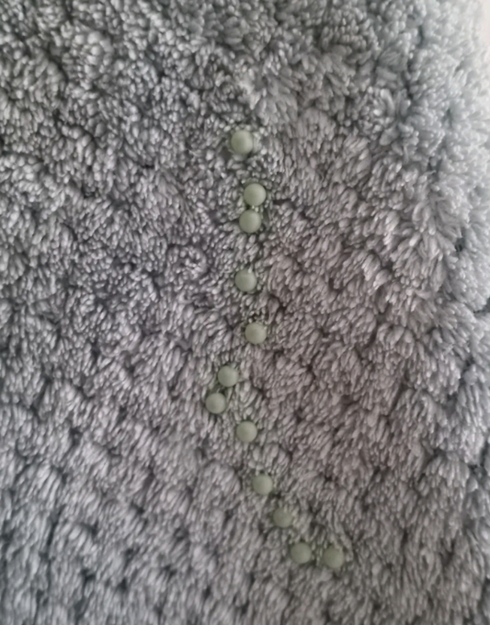 毛巾上怎么会有这个东西,这是不是虫卵啊?