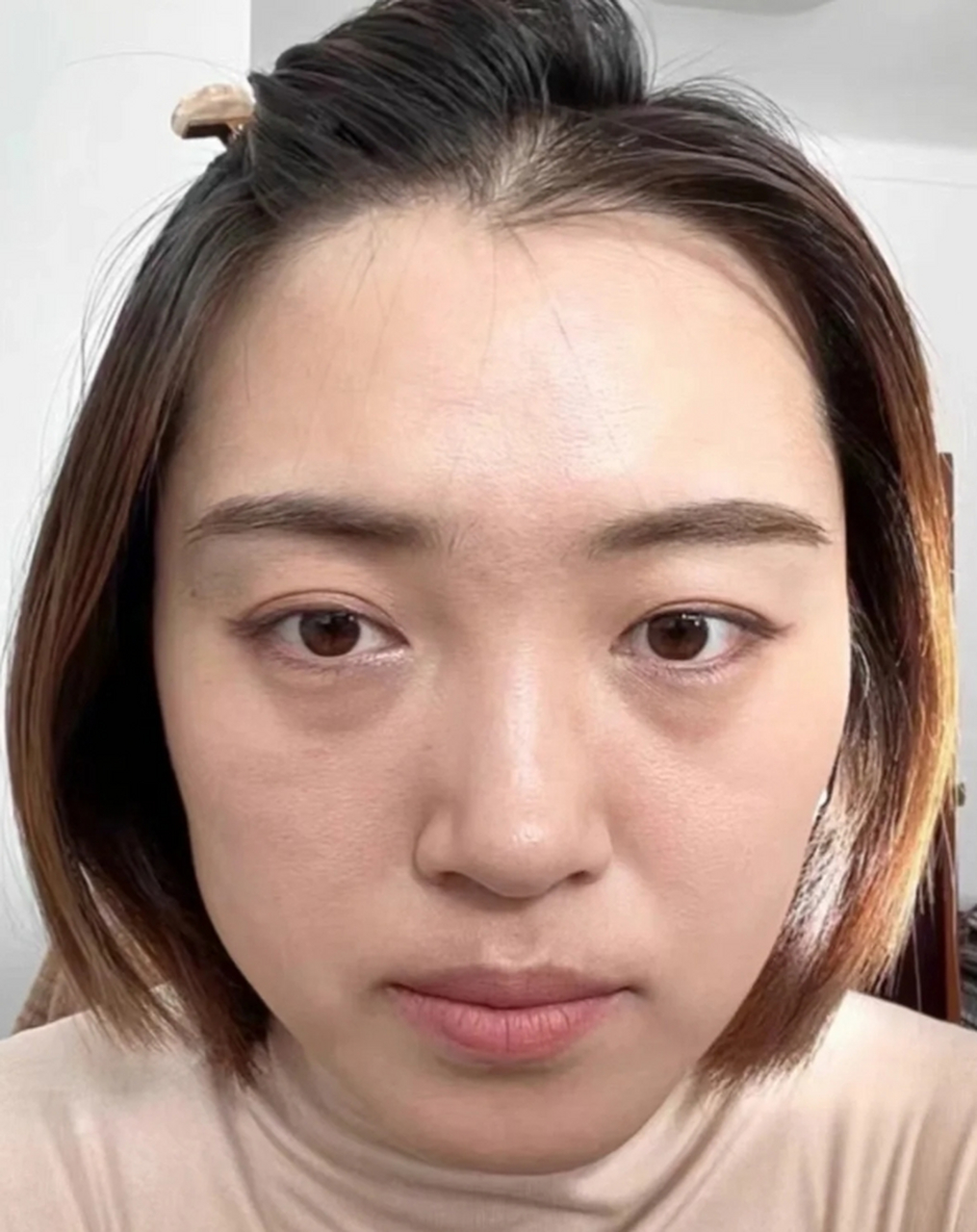 那么,怎样才能有效地消除黑眼袋呢?