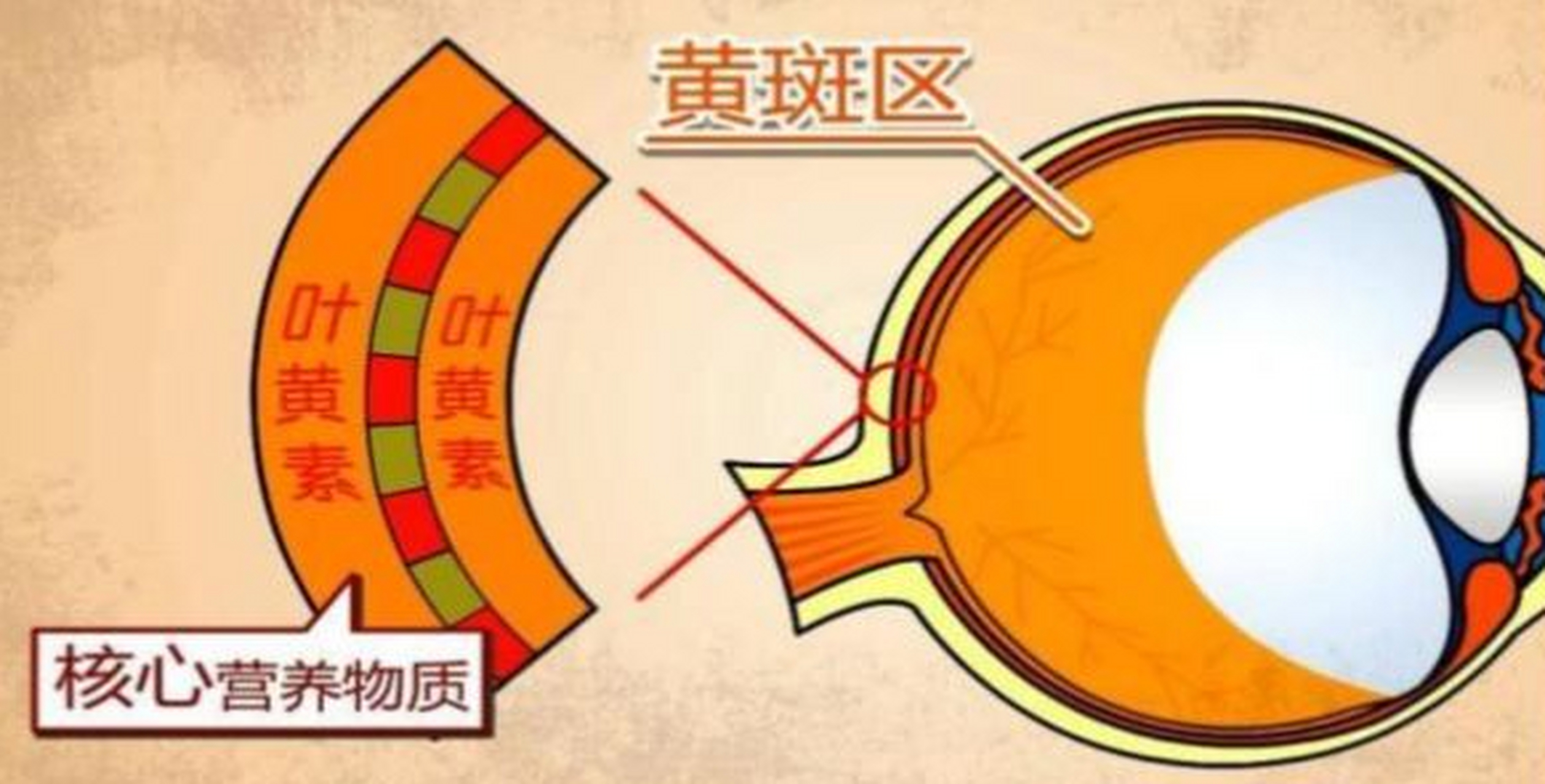 黄斑水肿指的是中心凹周围视网膜液体的积聚,水肿的形成原因有很多,由