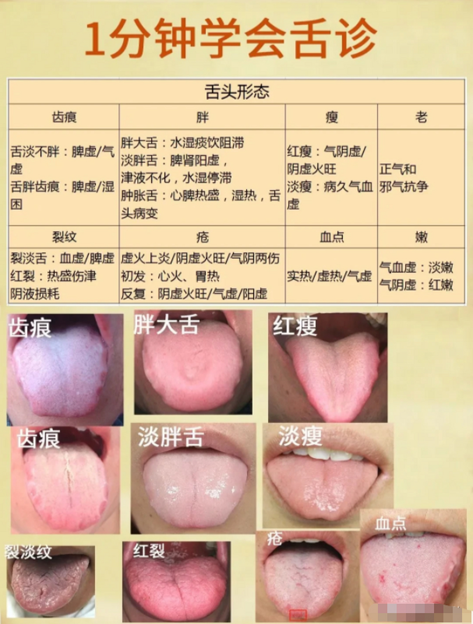 正常的舌苔图片 病症图片