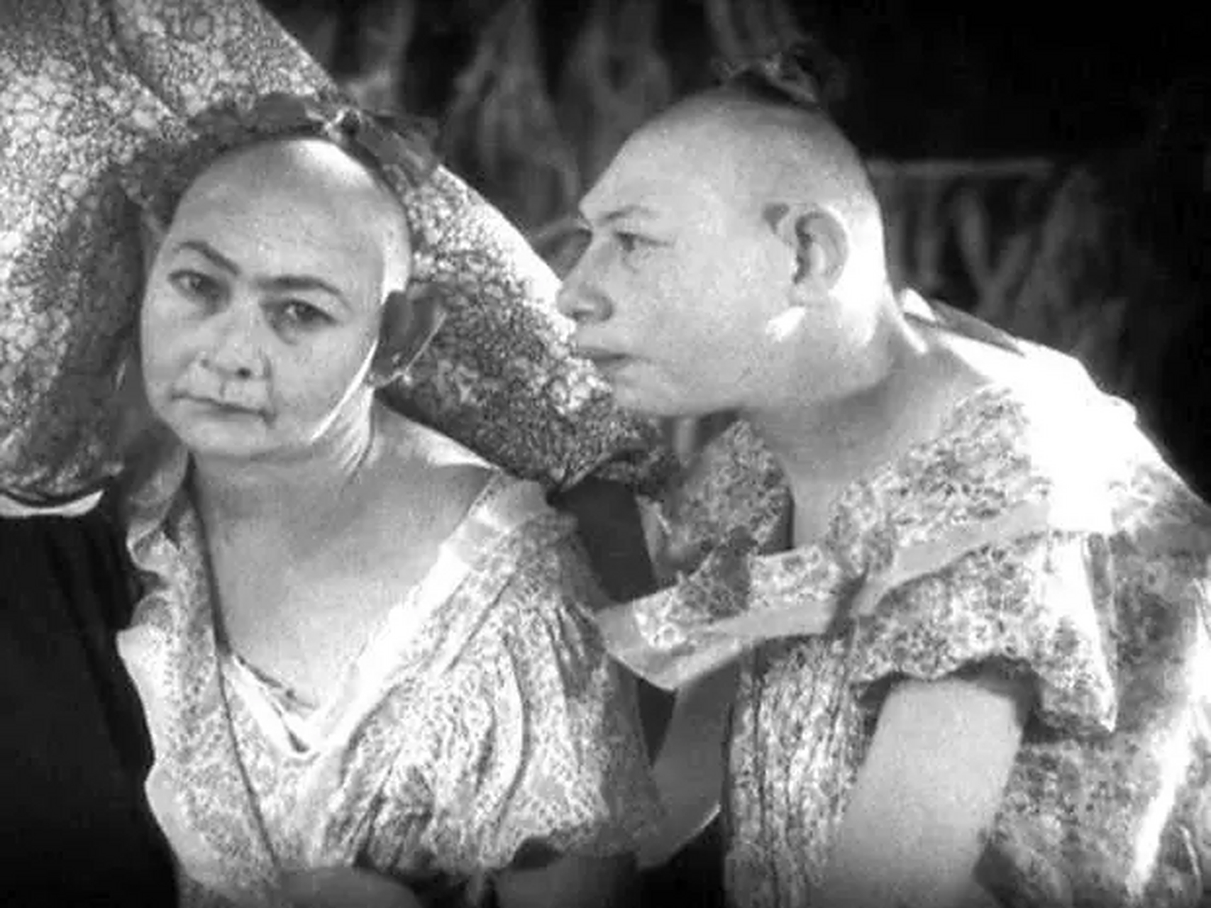 她们出生就患有头小畸形,头部非常小,智力发育迟缓.