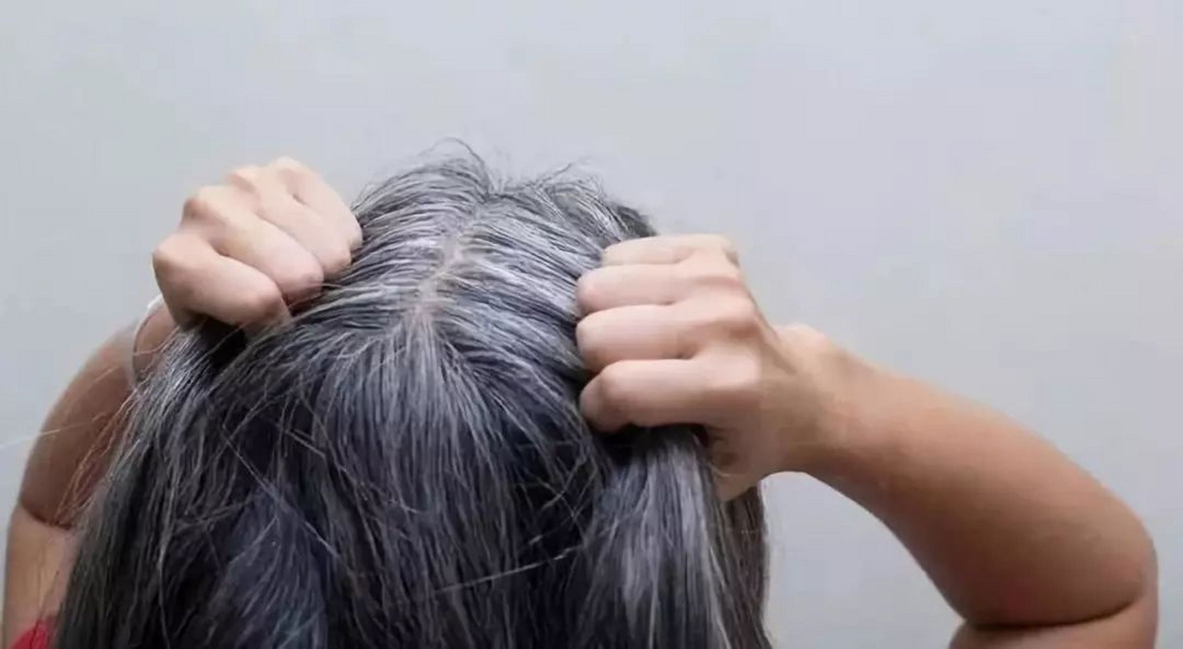 【头上白发的位置,暴露你的身体状况】  1,前额有白发:脾胃失调 前额