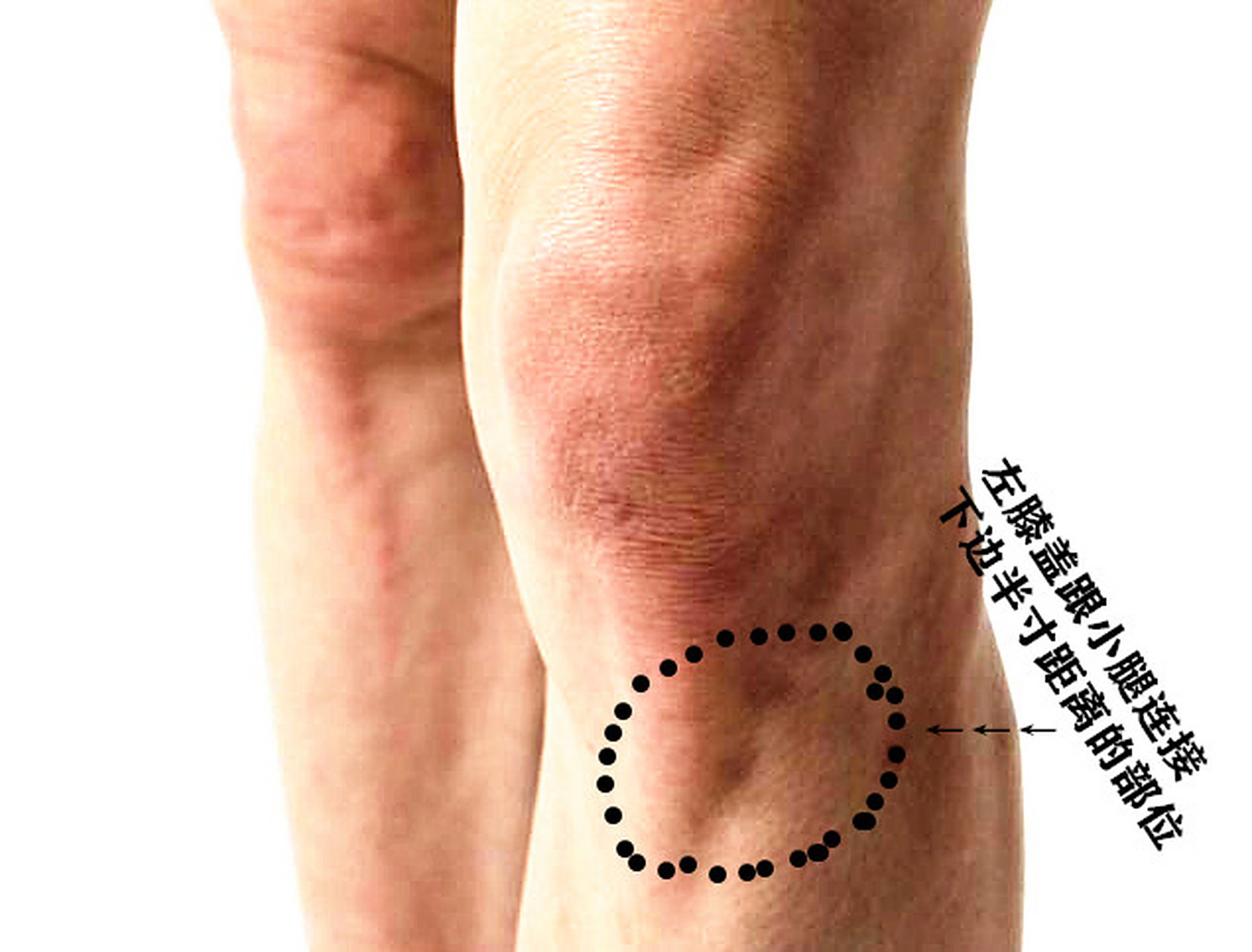 膝盖有痣 膝盖上中长有痣的人不多,膝盖上面有痣的人,有非常好的人生