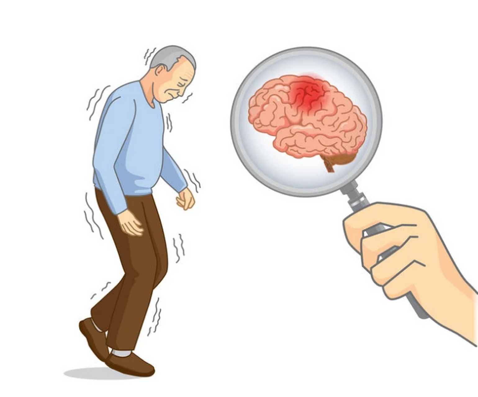 以下8类人群要特别注意, 如果你发生过脑梗,中风