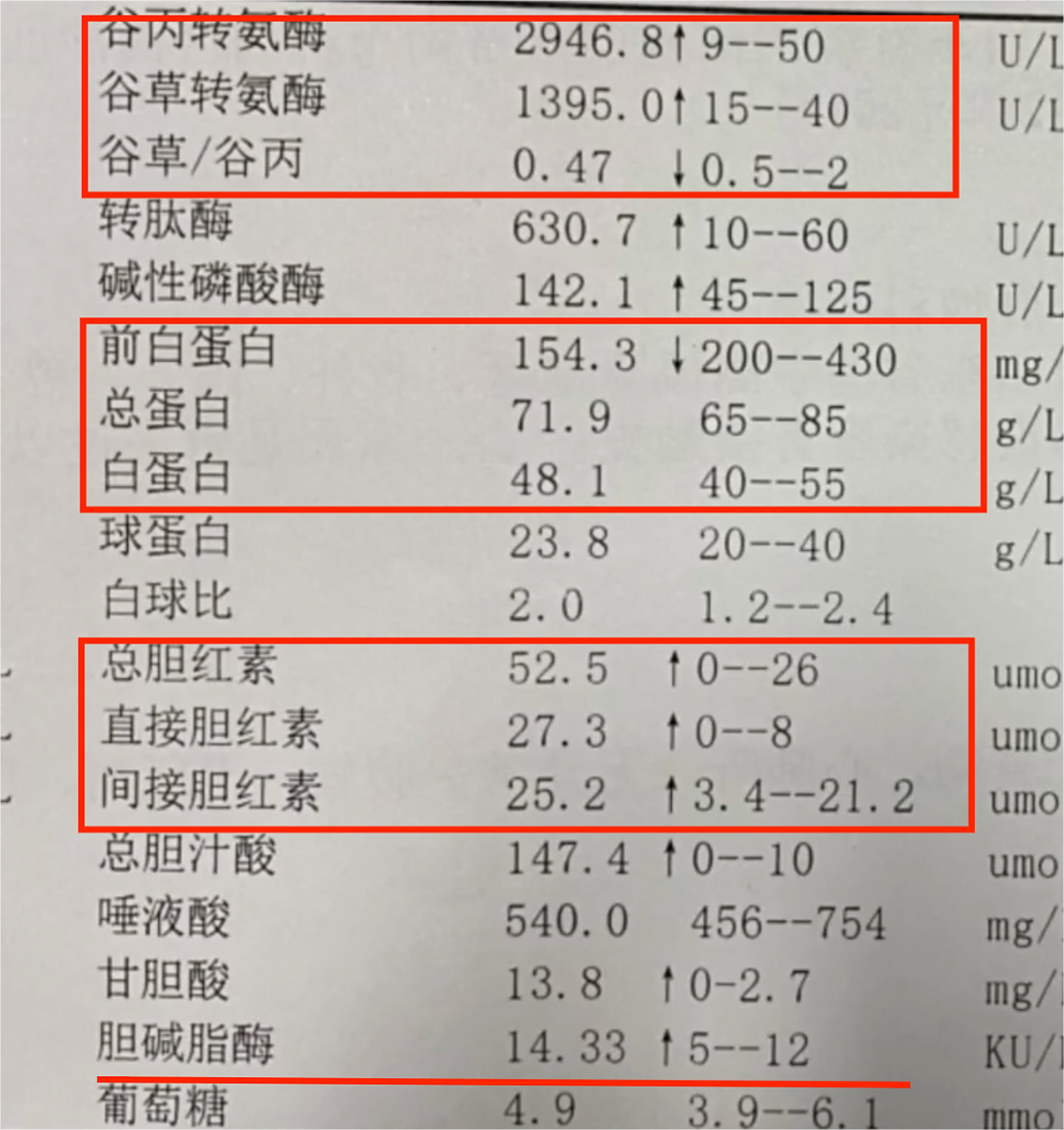 我来教你看肝功能化验单,肝脏功能是合成和代谢. 1,合成看白蛋白.