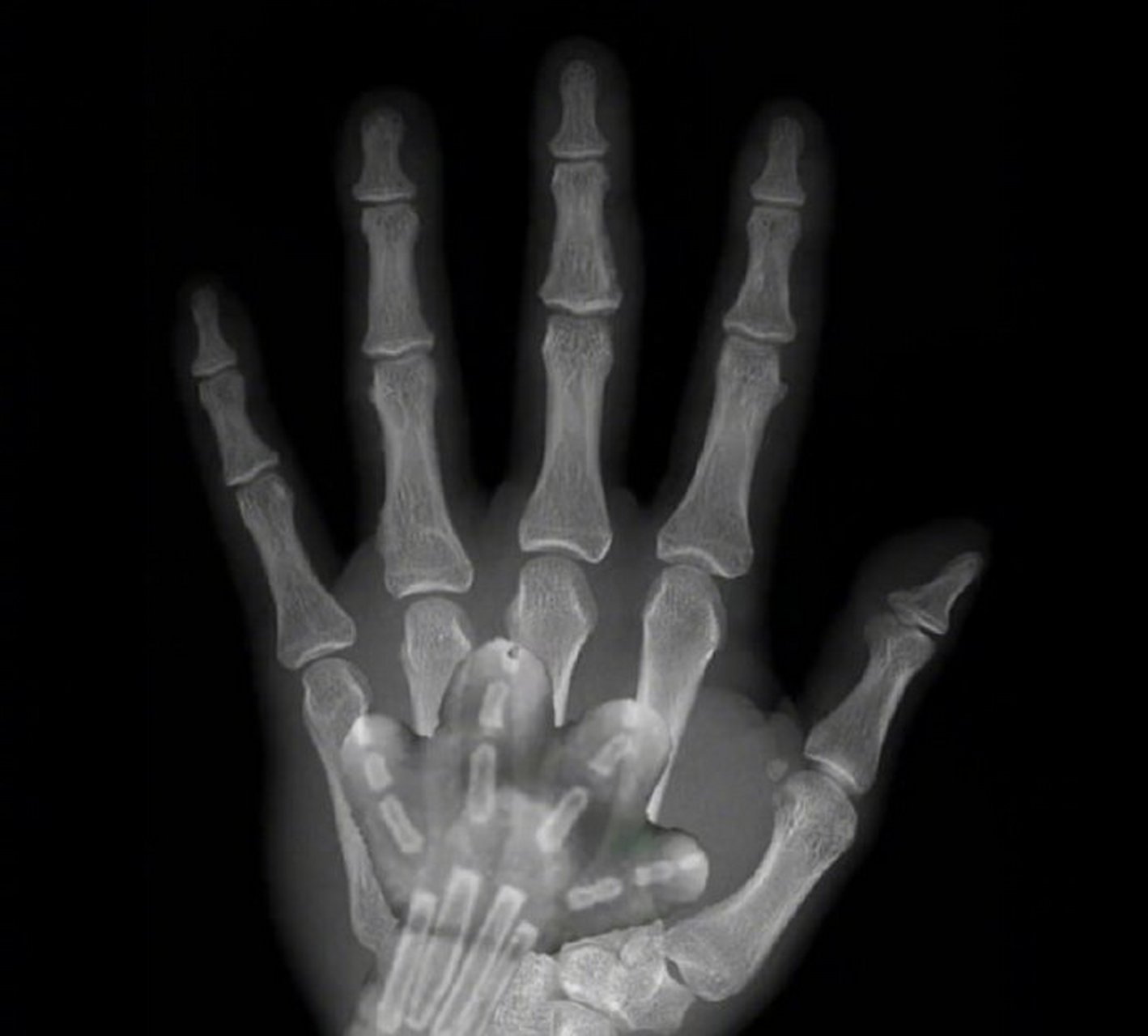 猫爪爪和人爪爪的x光片!这是要可爱死我吗~[大笑]#萌宠# #猫咪成精了