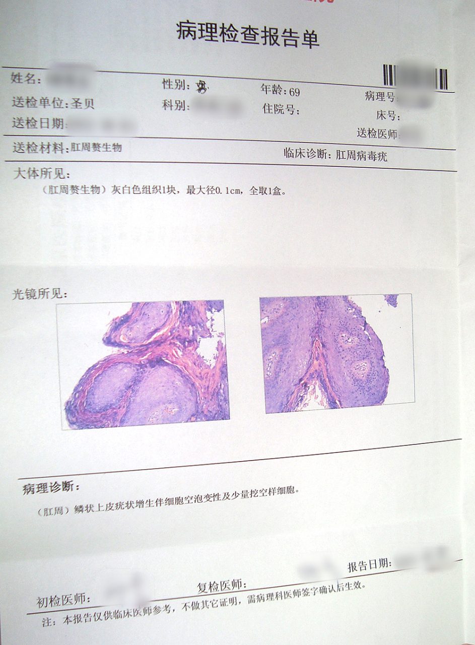 该患者男性,年龄69岁