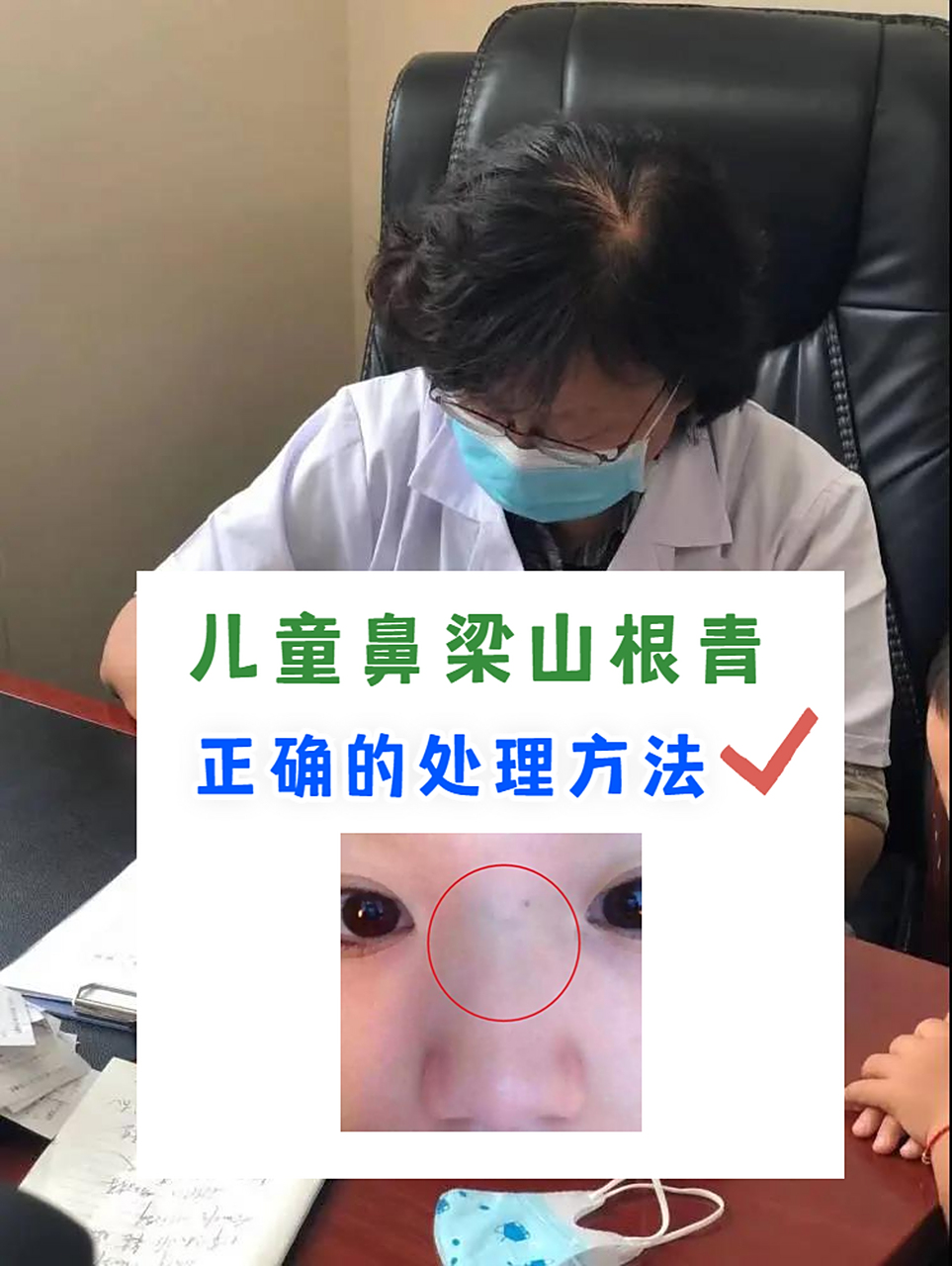 儿童鼻梁山根青,正确的处理方法!