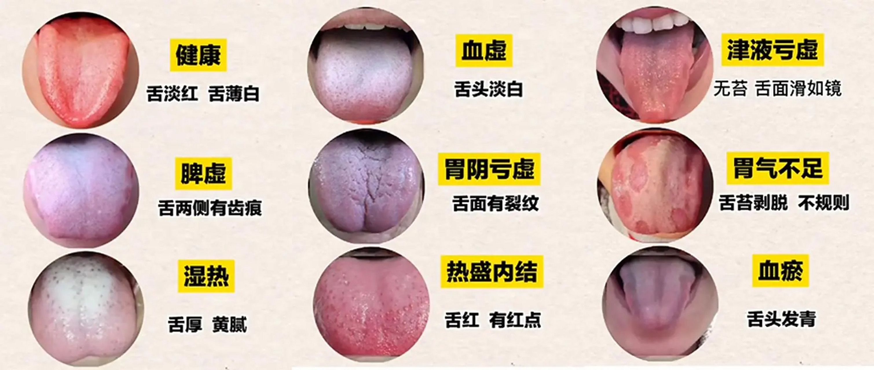 中医"舌诊"看的是什么 你知道中医望舌苔看的是什么吗?