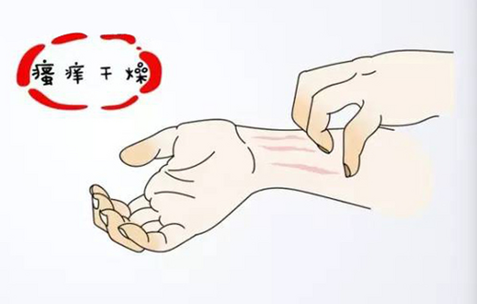 小诊所医生特色治疗皮肤瘙痒,湿疹 半年前在单位一次