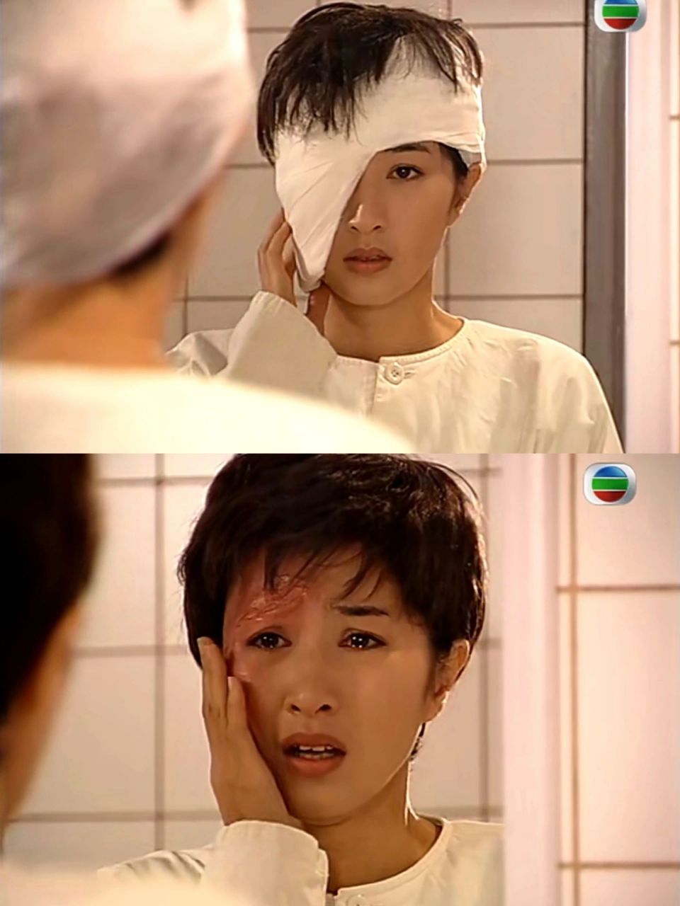 意外烧伤导致毁容,关咏荷这段演的真好 港剧烈火雄心第30集,感觉