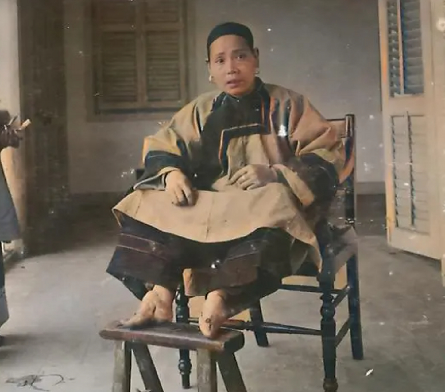 感,但是明清时期有些烂俗文人发展出一套所谓的"金莲美学",为缠足叫好