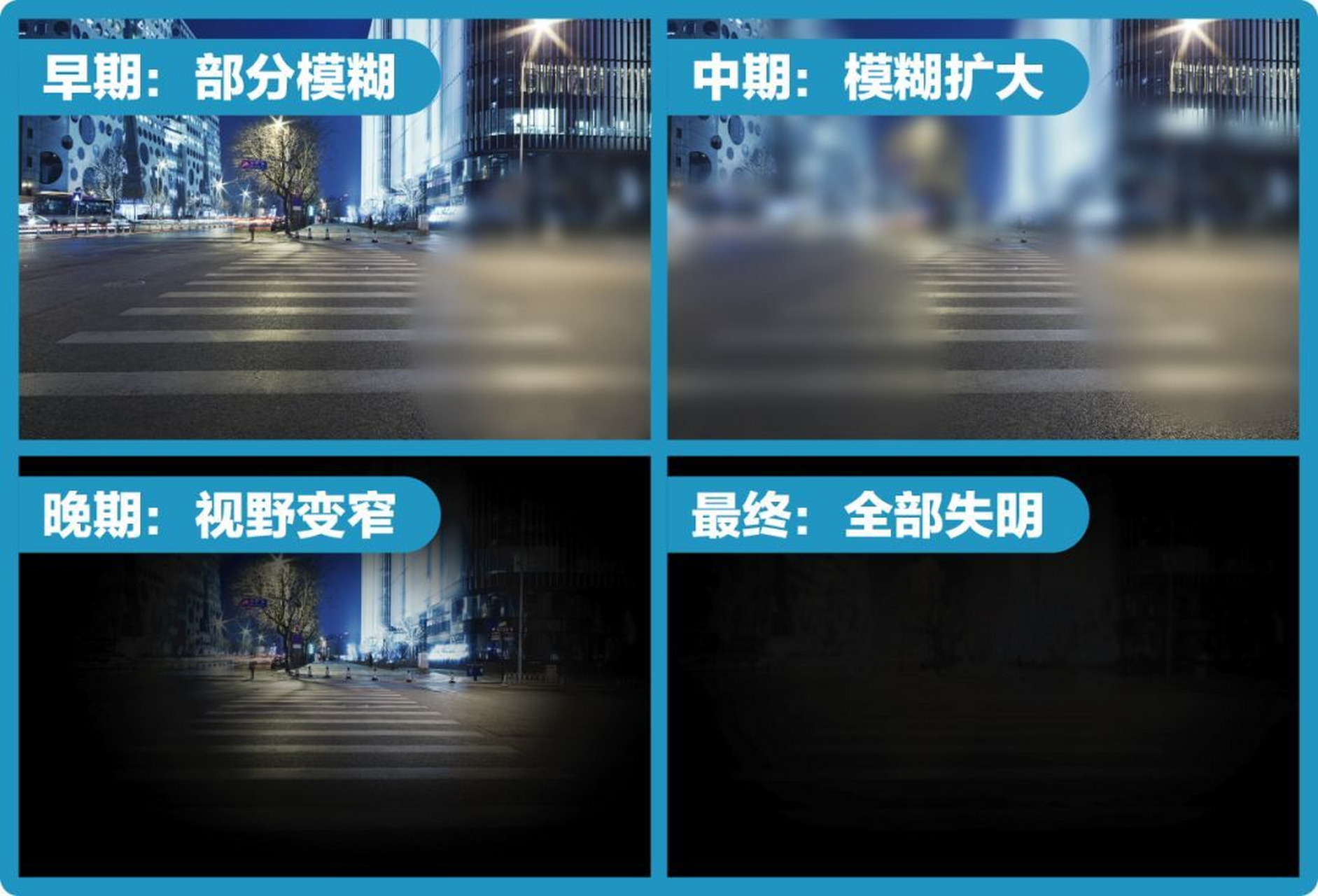 视网膜色素变性(夜盲)有办法治!  "这个病治不了,目前没有办法!