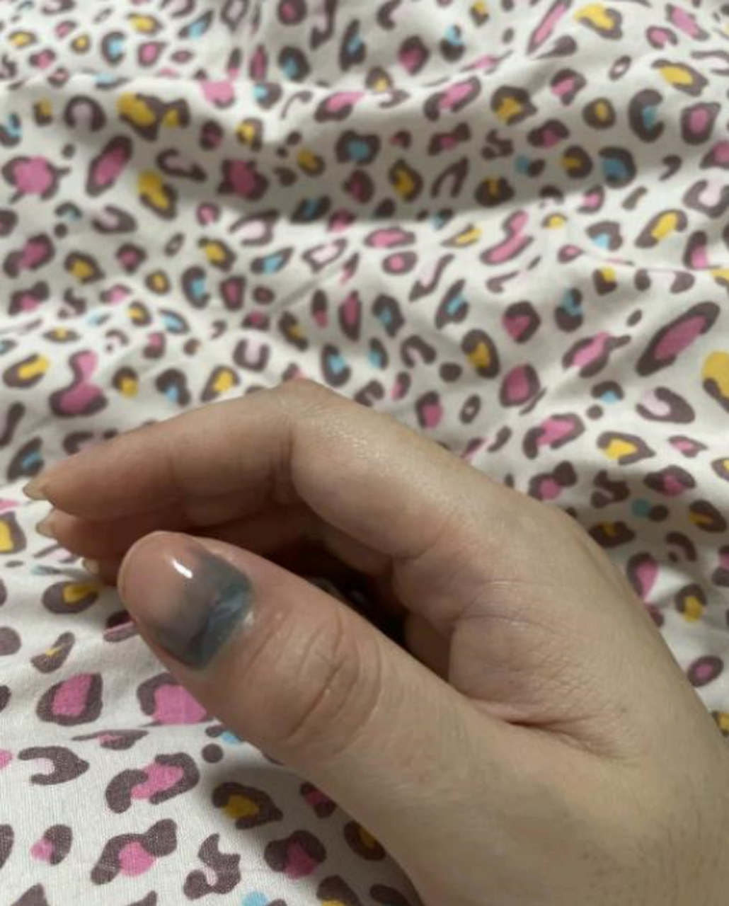 手被门夹到了,真的太疼了