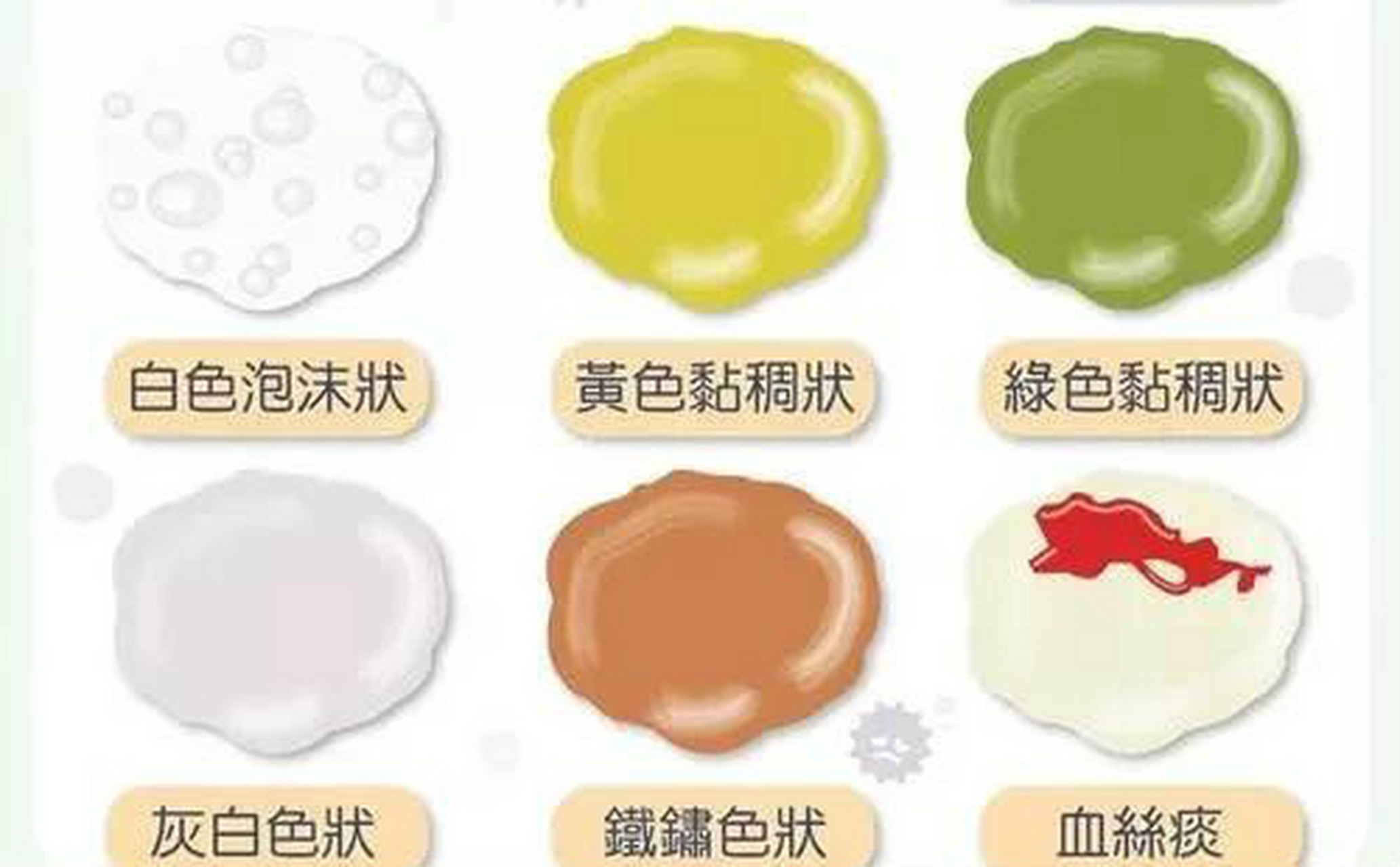 俗话说"黄痰轻,黑痰重,白痰要了命",是真的吗?一起来揭秘