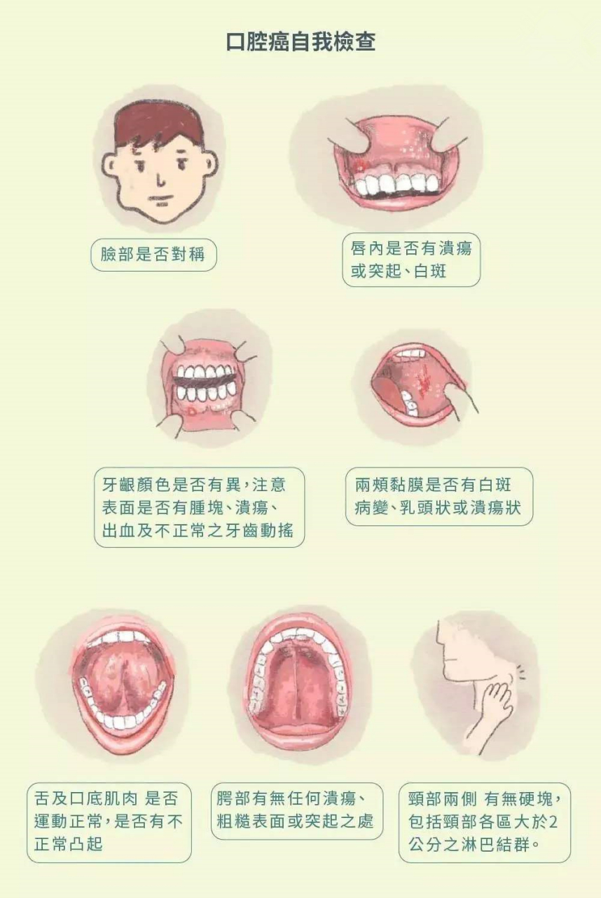 软硬腭癌早期症状图片图片