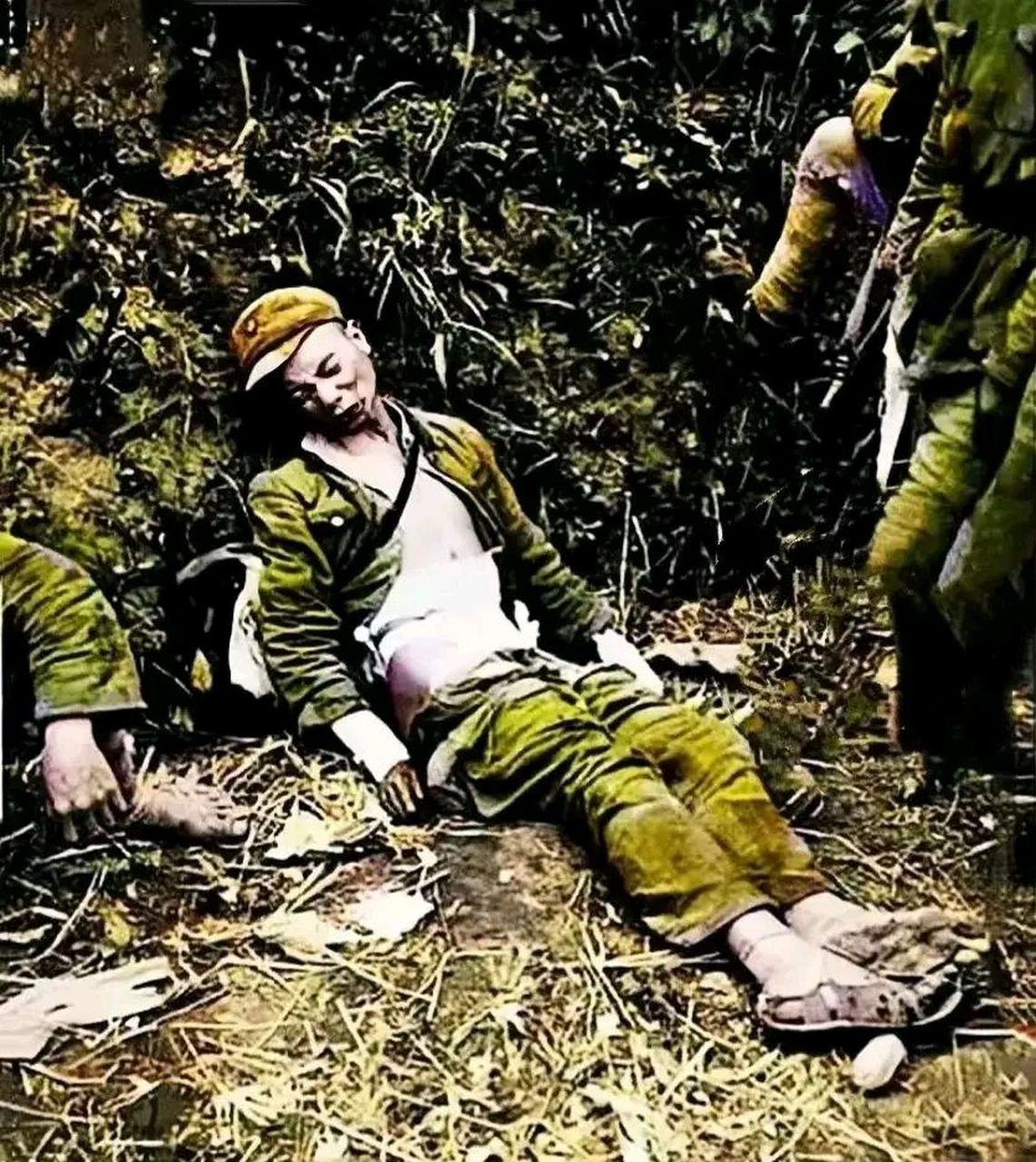 抗战时期,一名不幸受伤战士的真实留影,这位战士穿着破旧的军装,脚上