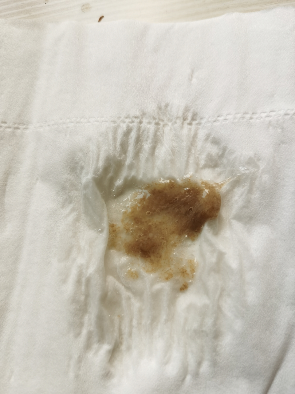 戒烟后咳出的黑痰,抽烟的时候倒没注意过有没有咳黑痰