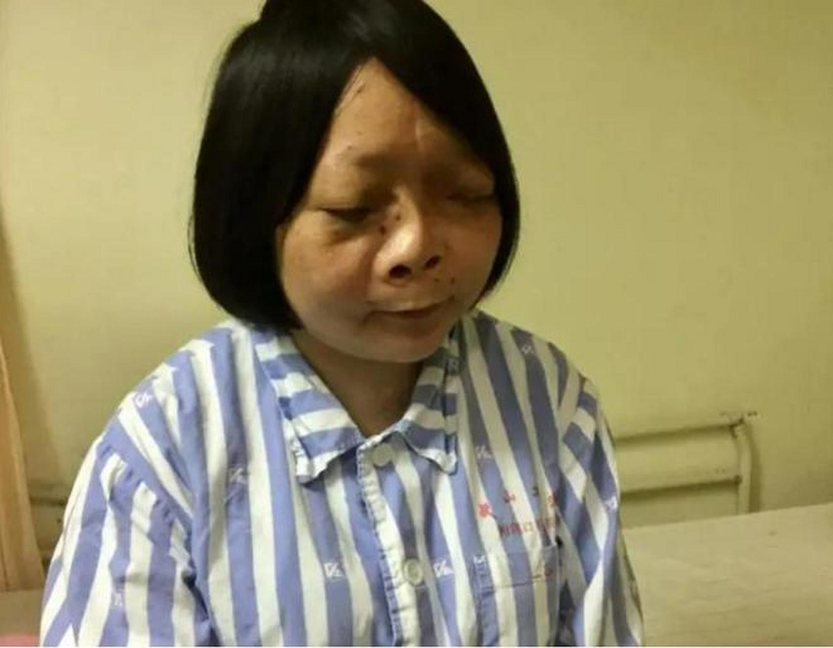 "一浙江女孩因疾病蒙面生活了13年,当她掀掉盖头后,饶是见多识广的