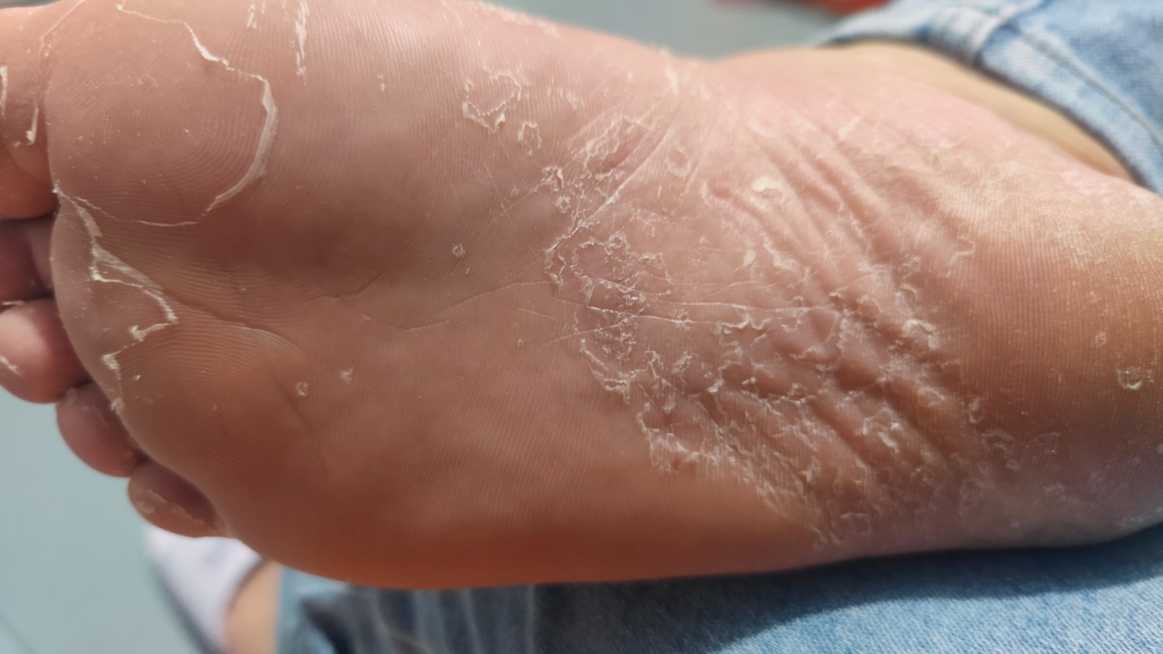 这是褪皮?图三是这个月的任务,这两件事有关联吗?