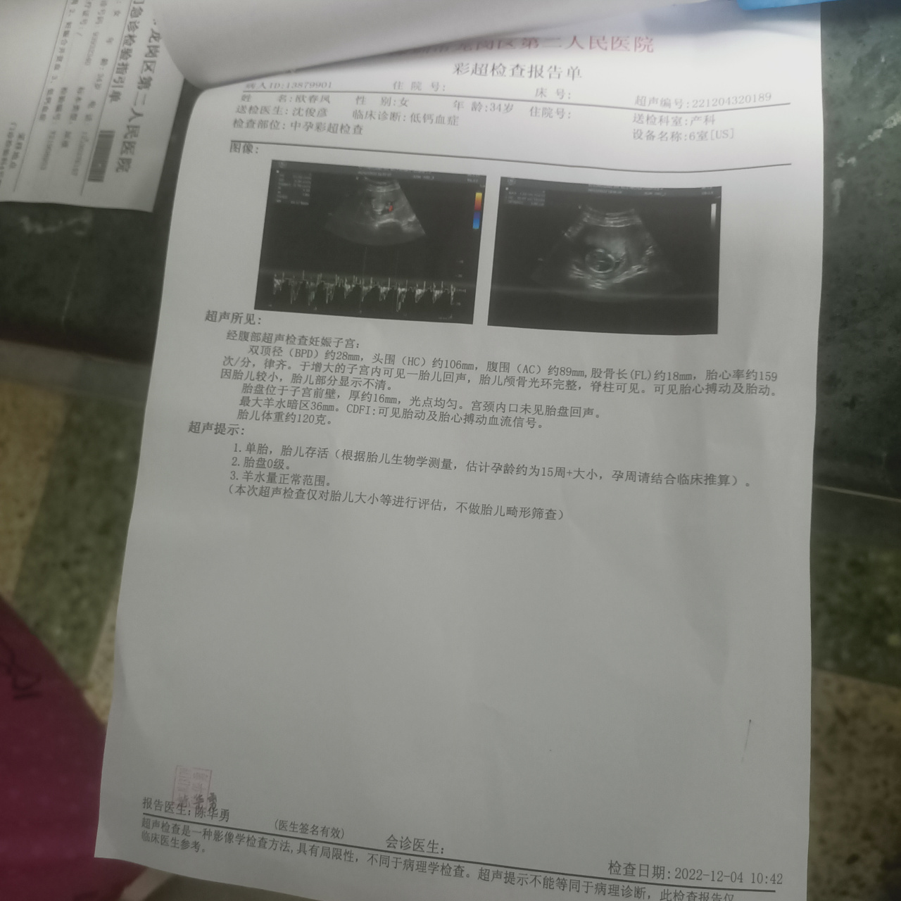 青春期的孩子爱面子大过天!