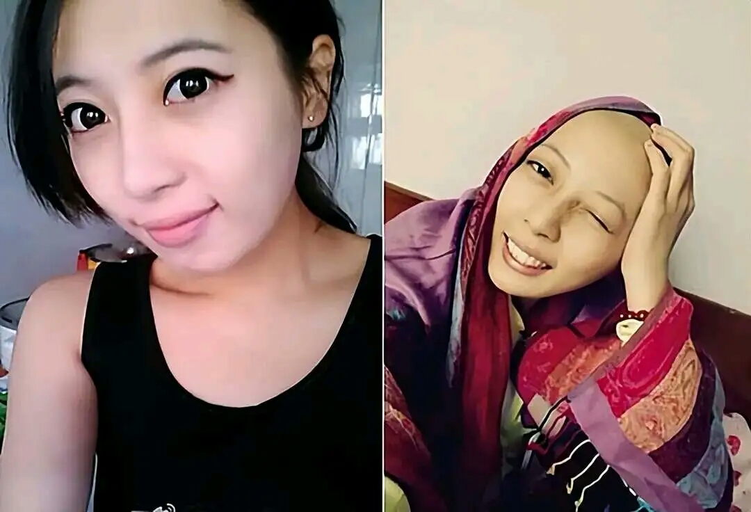 "最美抗癌女孩"鲁若晴的故事