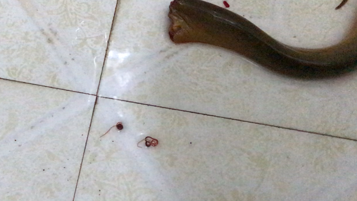 鳝鱼身上的寄生线虫,酷似铁线虫