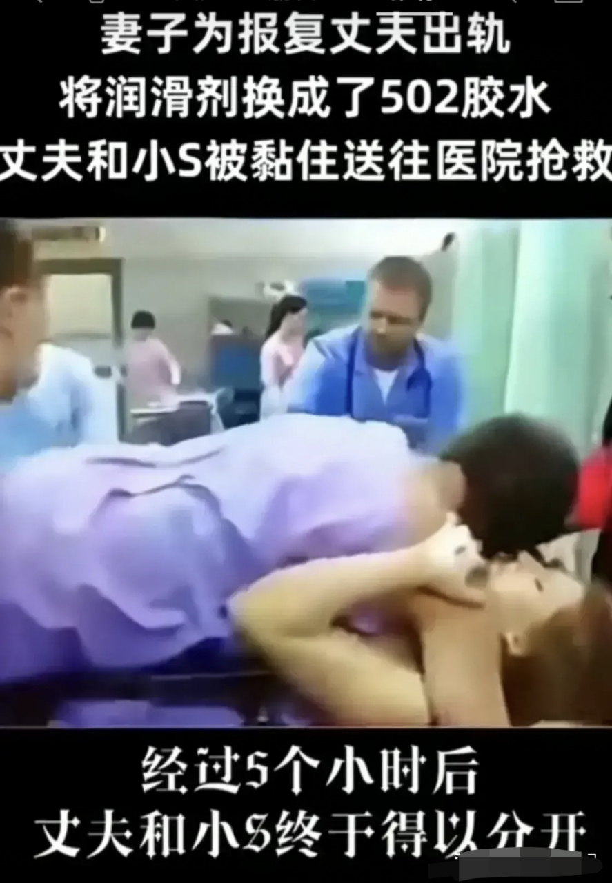 丈夫出轨,妻子怒将润滑剂换成502胶水,丈夫和小三被黏住送医院抢救5