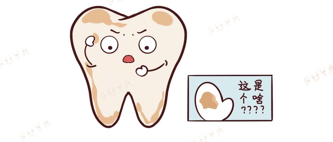 牙结石和牙垢到底有什么关系,可以不清理吗?