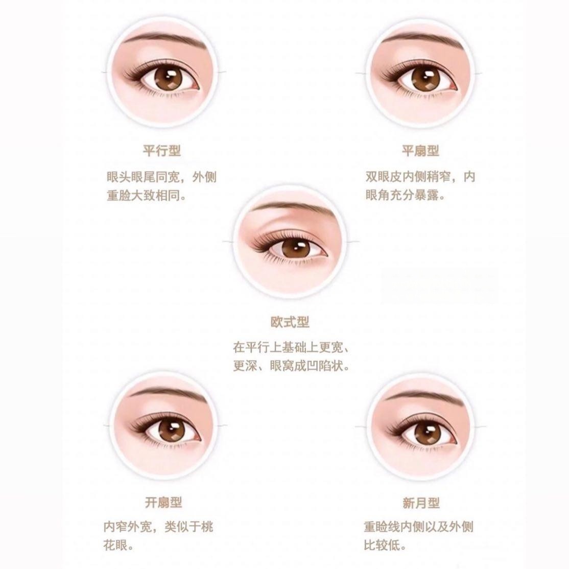 哪些眼型适合做双眼皮,而双眼皮具体又分哪几种呢?