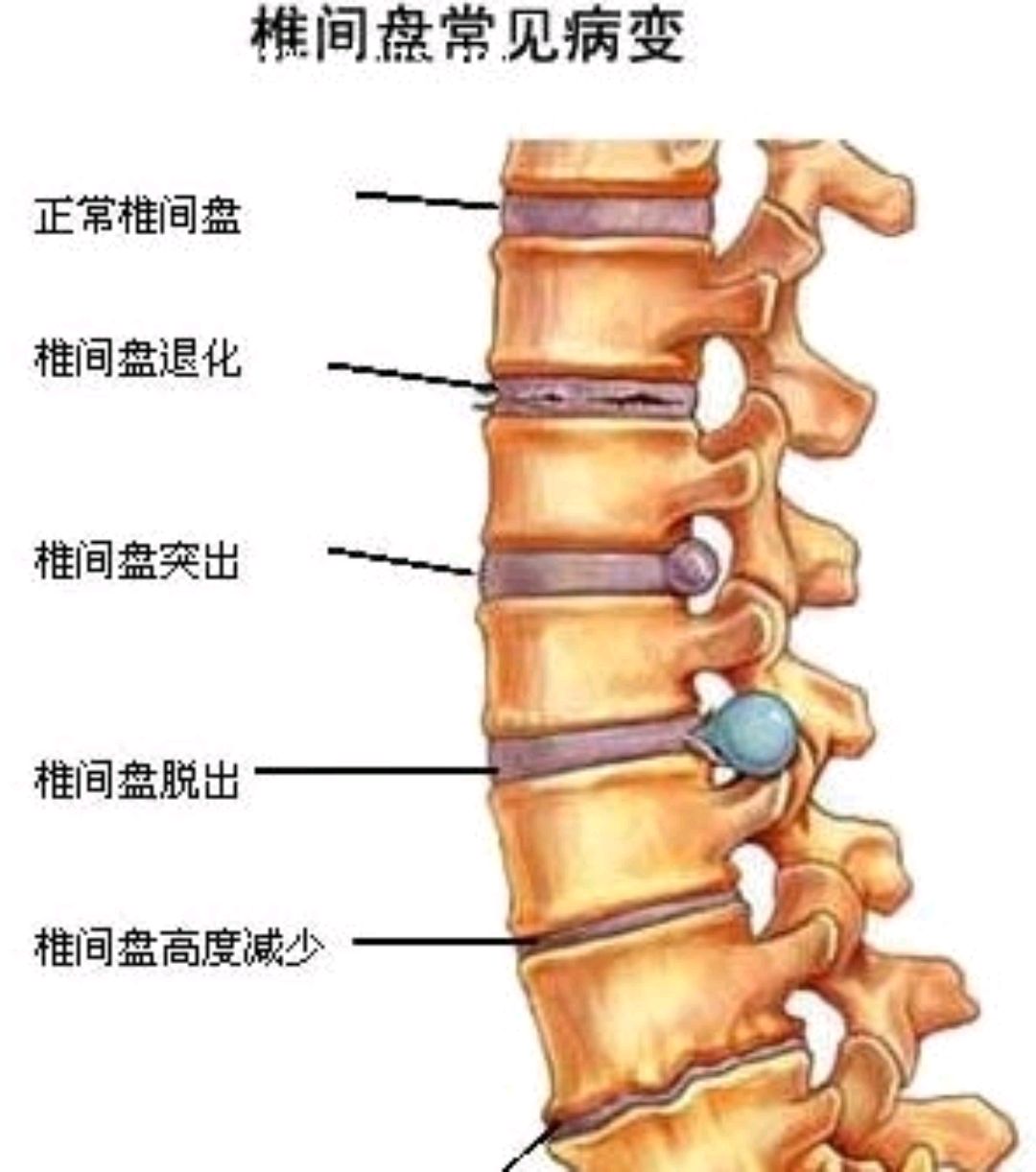 人体腰部结构图骨骼图片