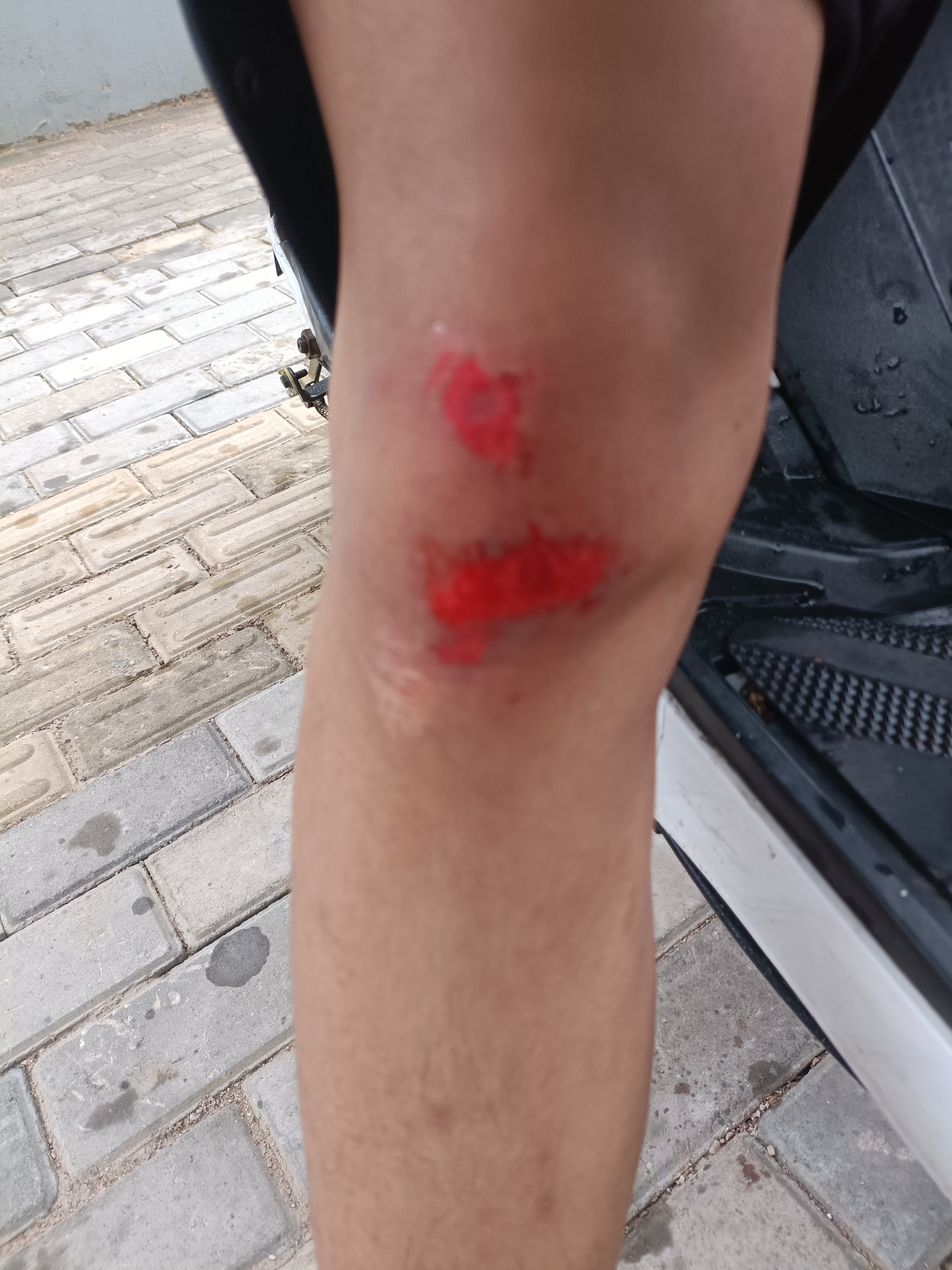 路上遇到彩虹喽,然后我去买了雨天摔伤图片100张下雨骑车摔跤图片