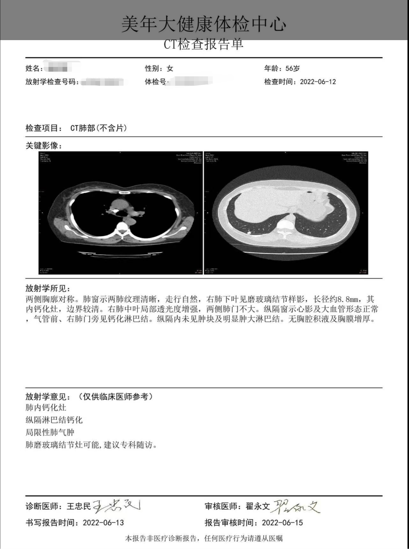 肺部良性肿瘤ct报告图片