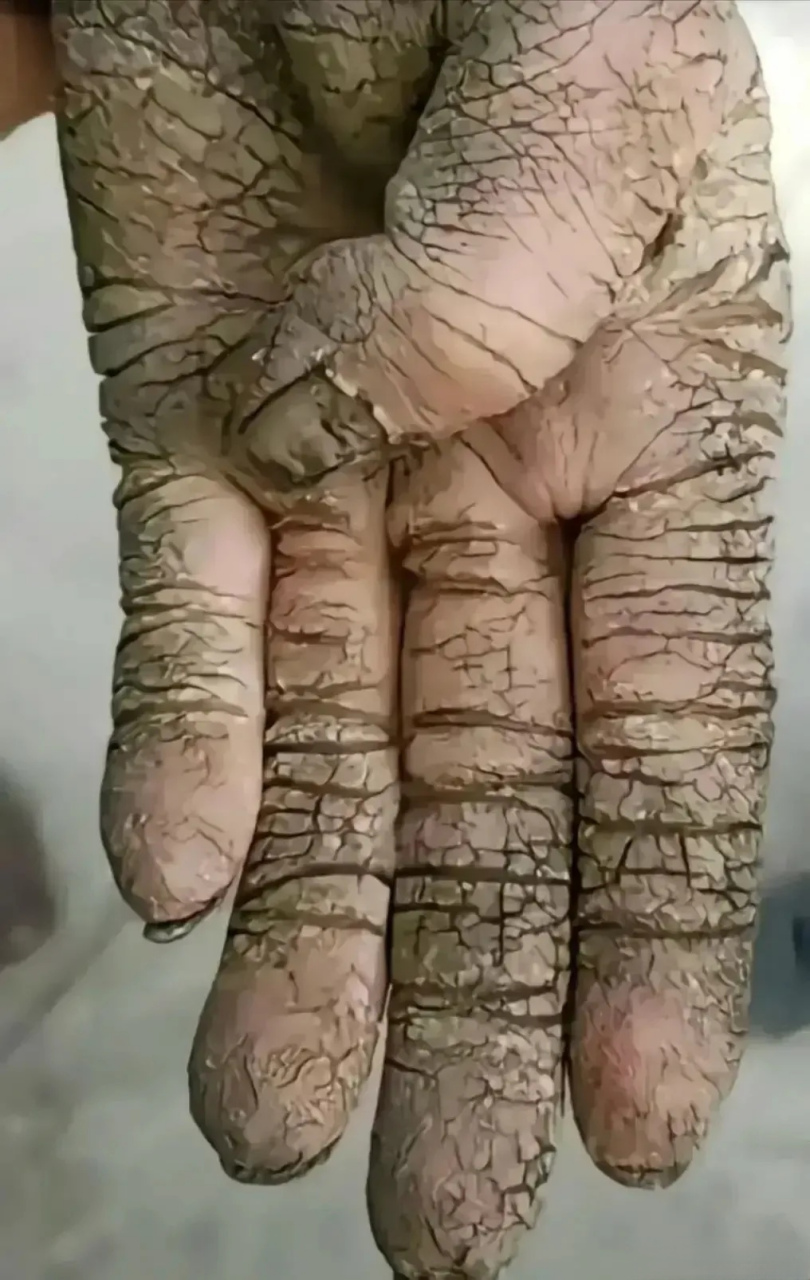 勤劳真的不能致富,选择大于努力 劳动人民的手!老农民真的辛苦,不容易