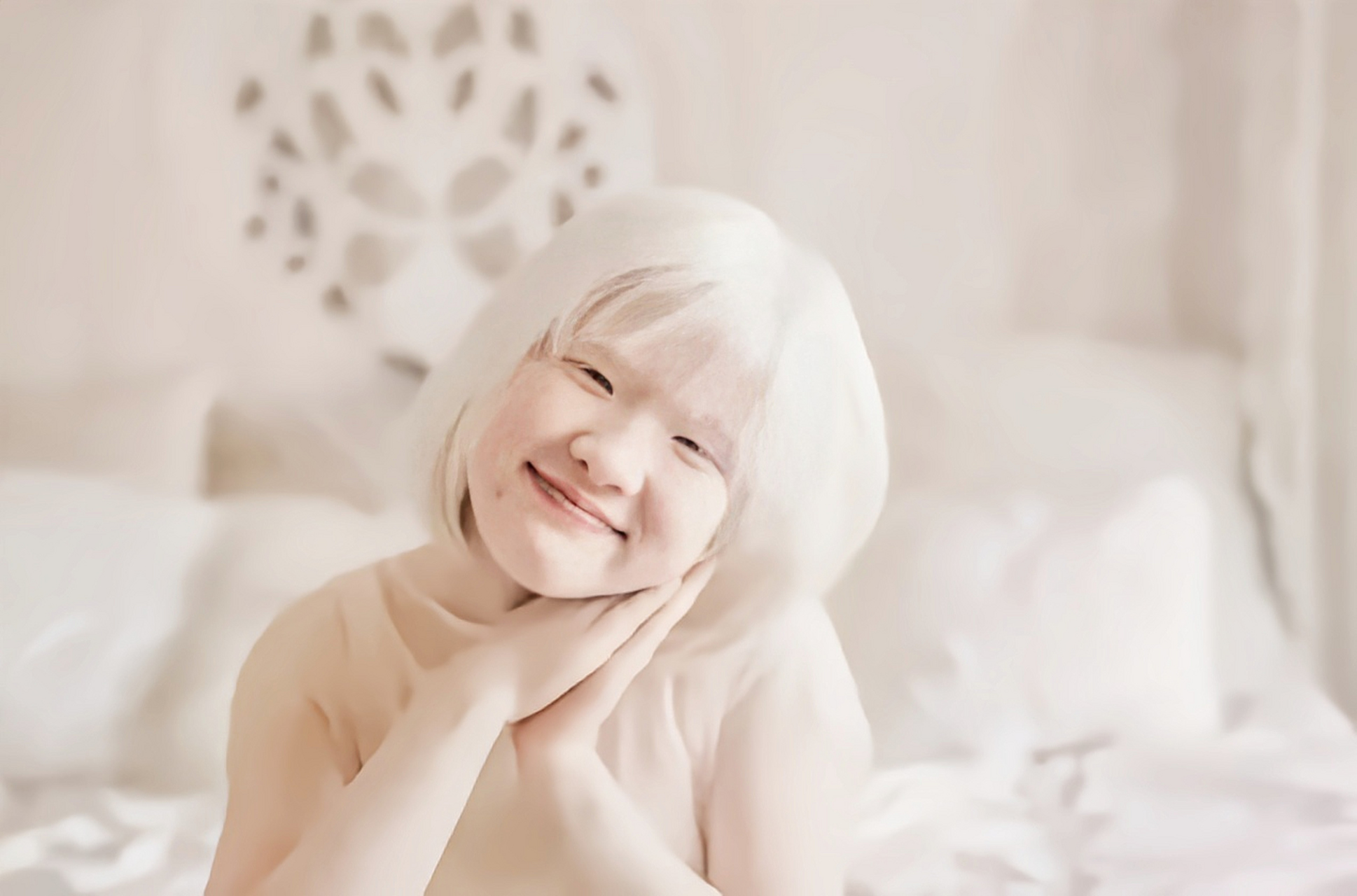 你所不了解的白化病:失去颜色的天使,他们还承受哪些痛苦?