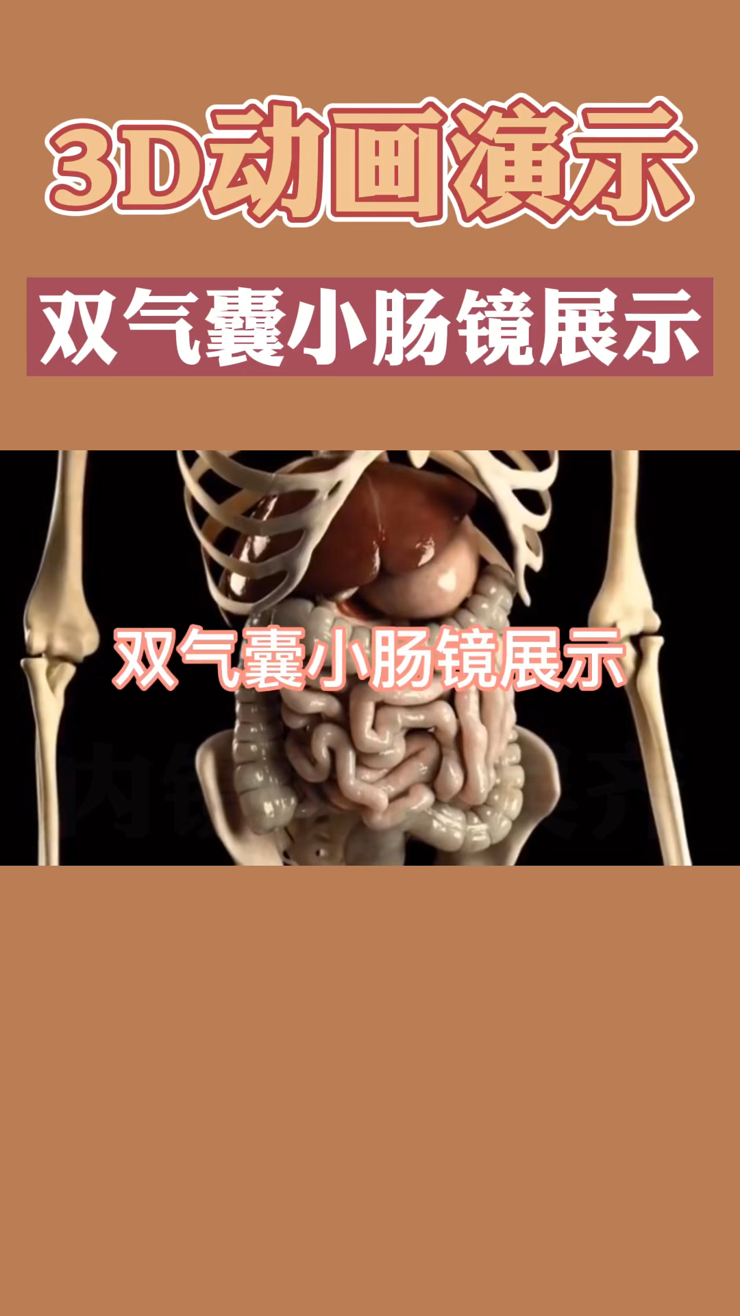 今日分享小肠镜如何检查长而弯曲的小肠3d动画演示带大家了解双气囊小