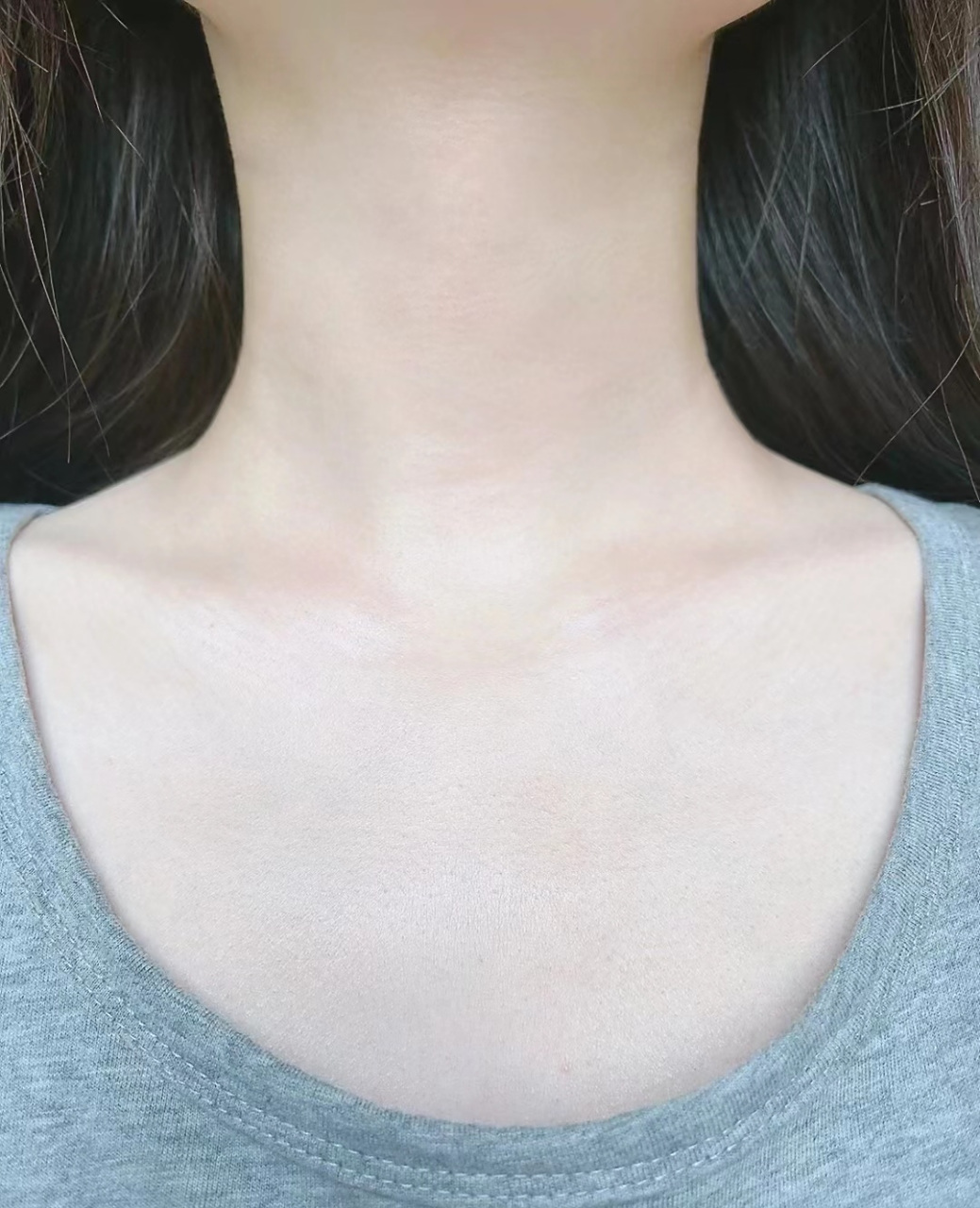 这么好看的脖子,你绝对没想到我有过甲状腺结节吧.