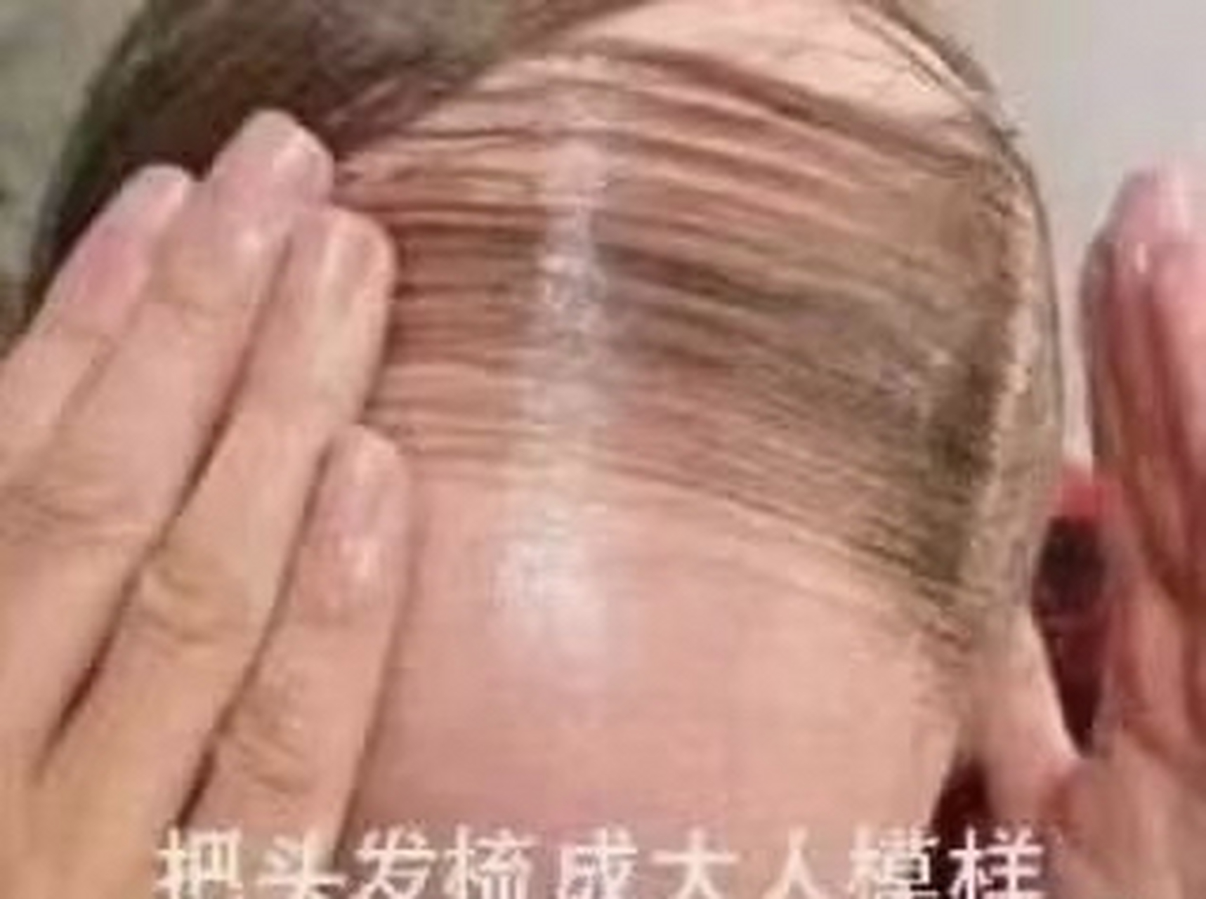 这几根头发是最后的倔强