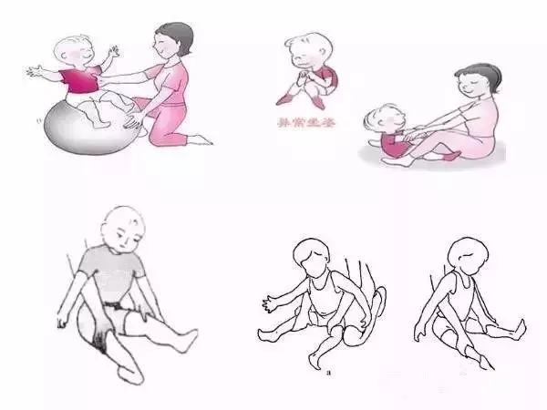 解析脑瘫治疗医院行业新趋势
